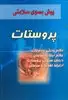 پروستات